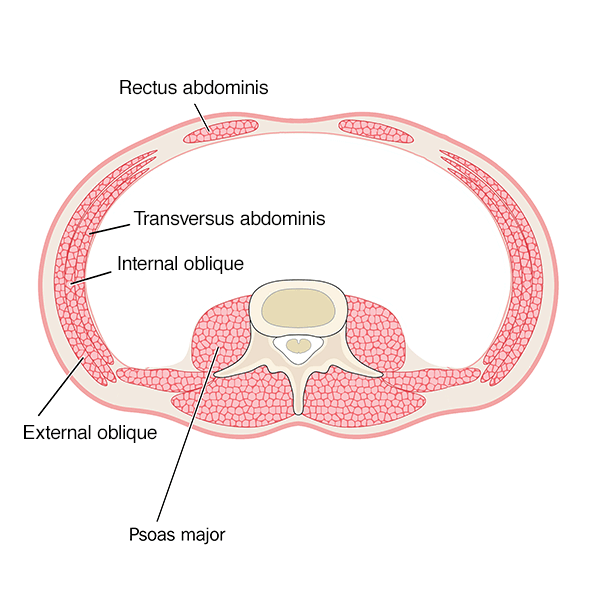 Abdominal Wall Reconstruction Perth Hernia Institute